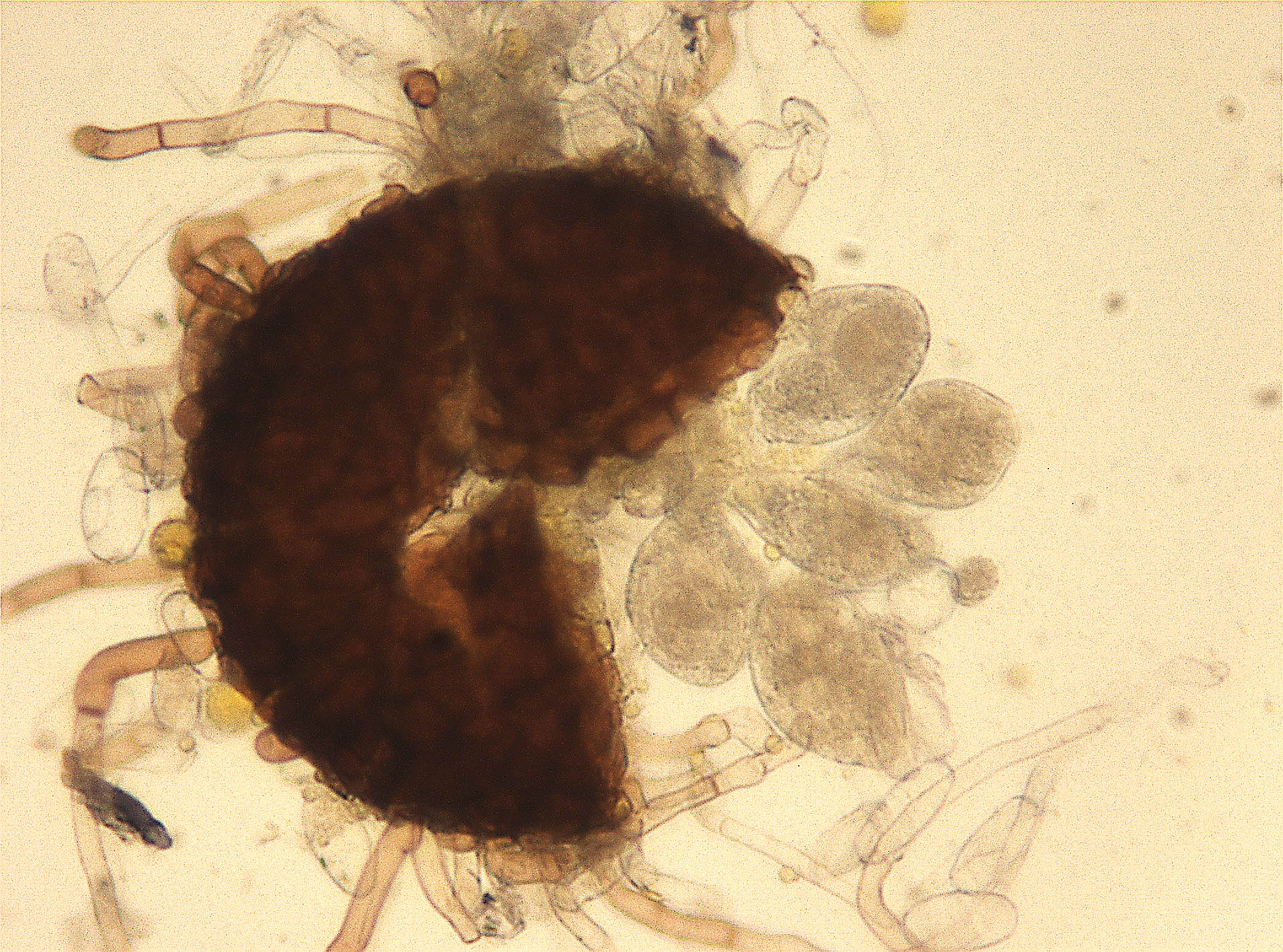 Sclerotinia sclerotiorum 1 Apothecium