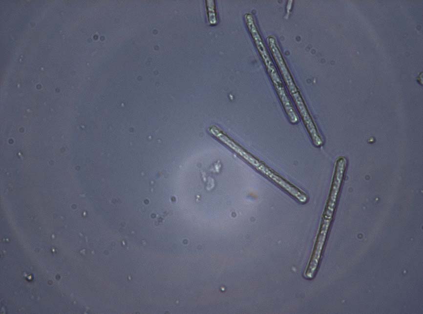 Cylindrocladium buxicola