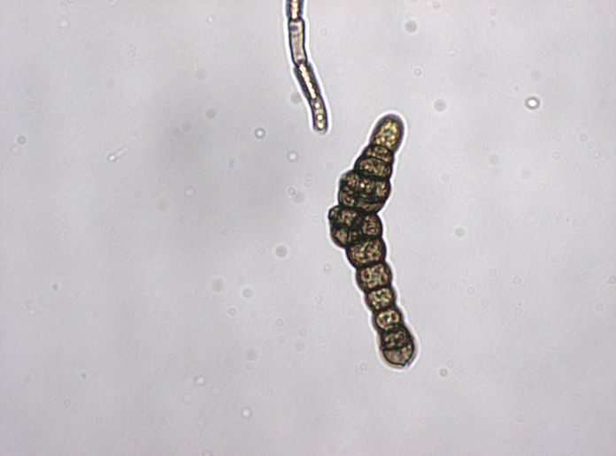 Alternaria laucanthemii