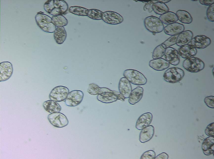 Sphaerotheca macularis f. sp. fragariae (S. alchemillae)