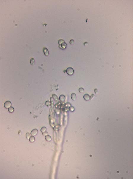 Penicillium sp.